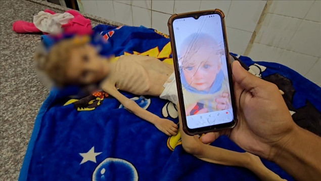 Još jedna beba preminula od pothranjenosti u Gazi