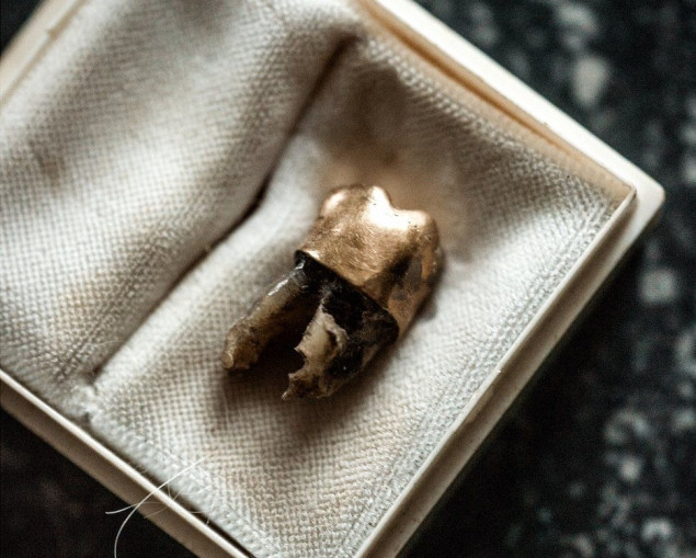 Belgija vratila Kongu zlatni zub bivšeg premijera