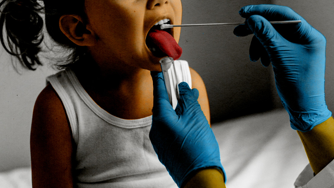 Od posljedica infekcije bakterijom Strep A preminulo najmanje 30 djece