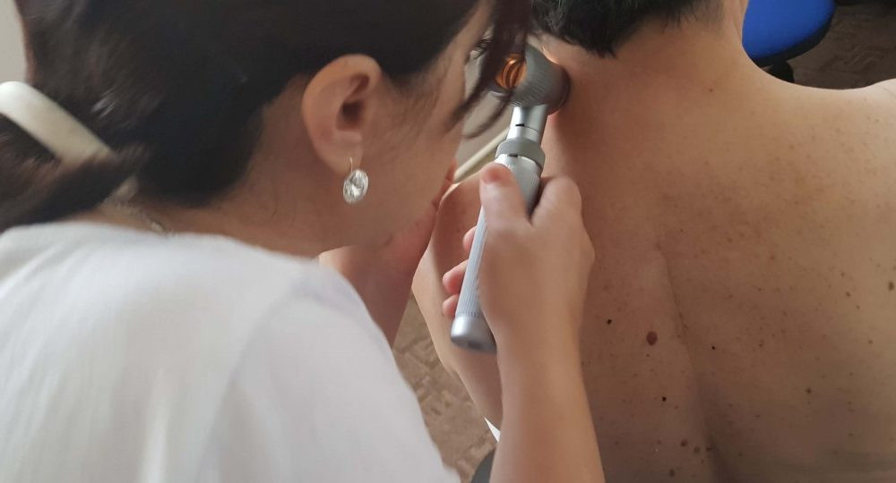 Ministarstvo zdravstava KS uvodi novi besplatni skrining za melanom