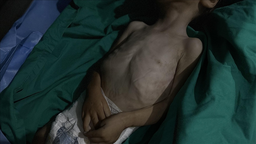 Broj umrlih od gladi u Gazi porastao na 428 dok Izrael drži prelaze zatvorenim