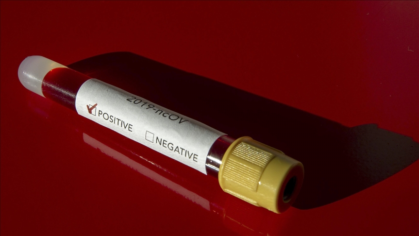 U RS-u još 192 osobe pozitivne na koronavirus, zabilježeno šest smrtnih slučajeva
