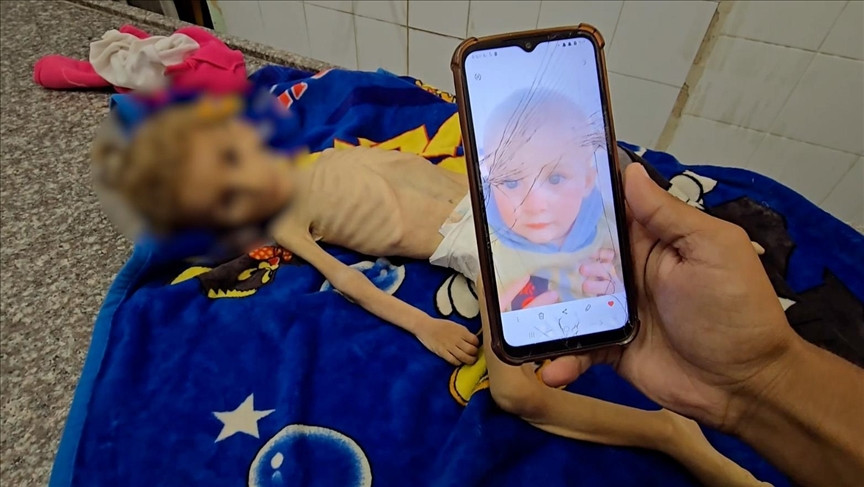 Još jedna beba preminula od pothranjenosti u Gazi