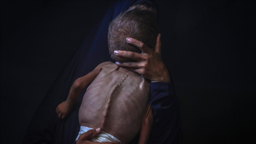 Više od 40.000 beba u Gazi u smrtonosnoj opasnosti zbog izraelske blokade