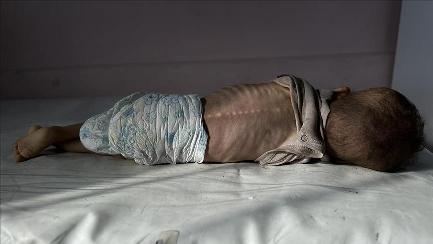 UN: Rekordan broj pothranjene djece u Gazi, skoro 12.000 u julu