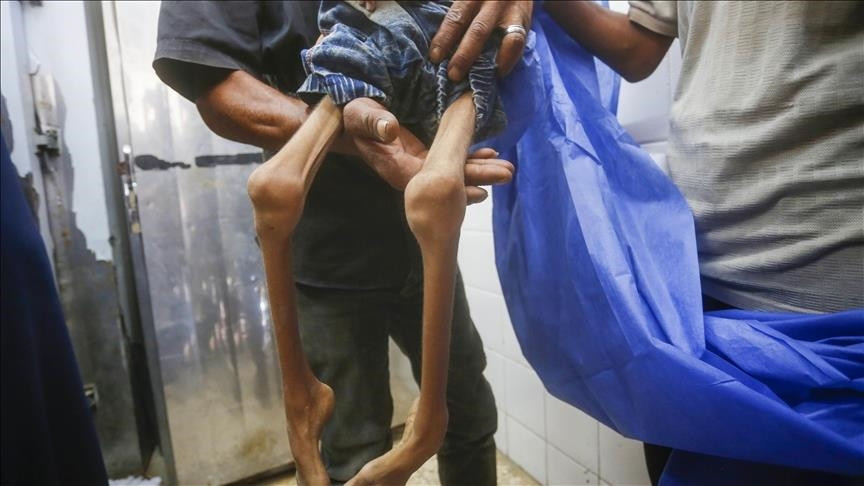 Još jedno palestinsko dojenče umrlo od pothranjenosti u Gazi zbog izraelske blokade