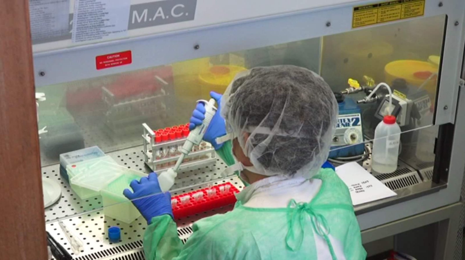 U TK-u 63 osobe novozaražene koronavirusom