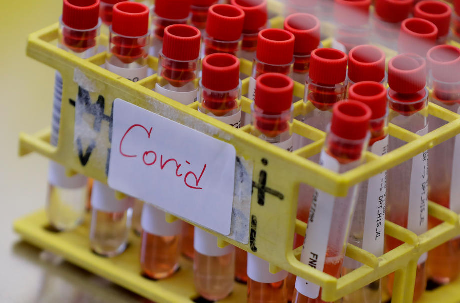 1.315 novih slučajeva zaraze, preminulo 37 osoba, 877 se oporavilo