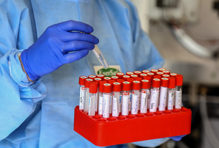 U BiH još 394 osobe pozitivne na koronavirus, 17 smrtnih slučajeva